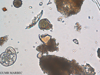 phyto/Scattered_Islands/europa/COMMA April 2011/Akashiwo sanguinea (ancien Dino 25 -ancien Dino w > Dino w cf gymnodinium sanguineum)(copy)_thumb.jpg